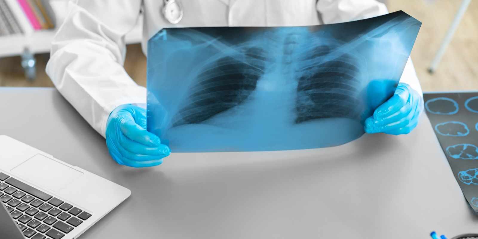 Doctor examining lungs x-ray scan in his office in hospital