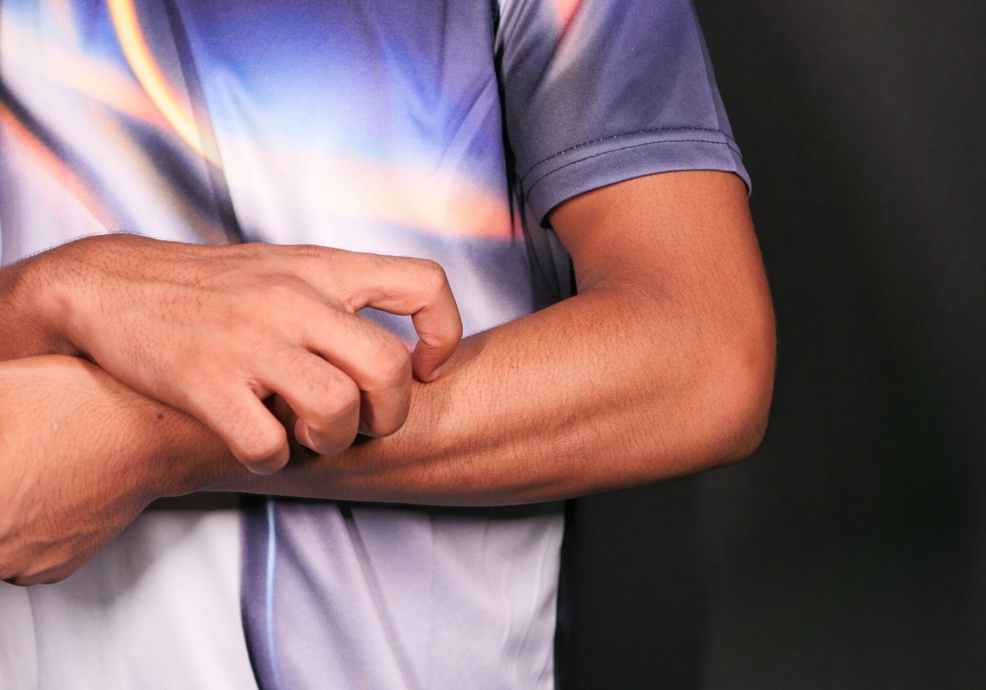 Man with Painful Arm - Shingles Concept