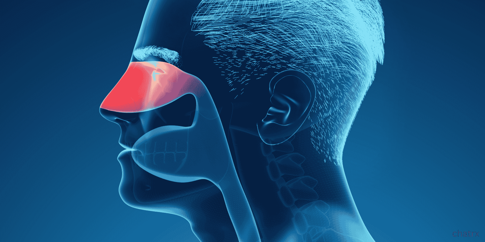 Can Sinusitis Be Caused by a Cold or Flu