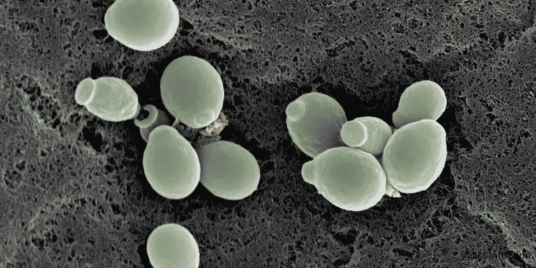 yeast infection treatment