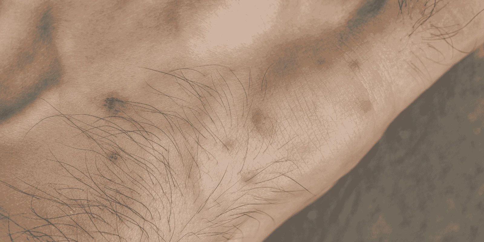 tick bites pets human health risks transmission prevention