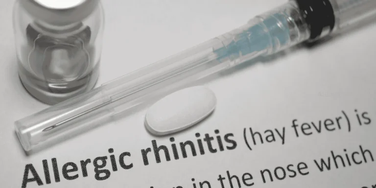Allergic Rhinitis