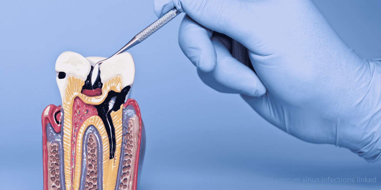 deviated septum sinus infections linked